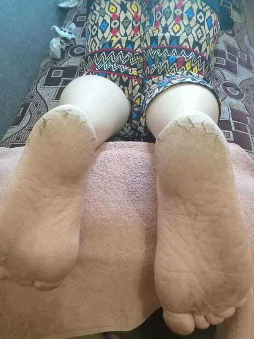 Педикюр  на дому