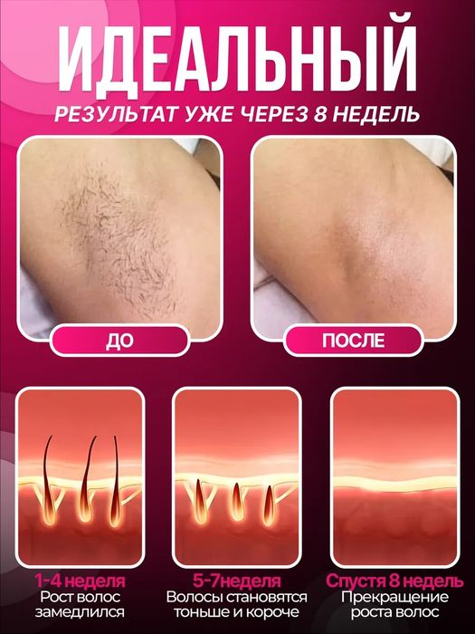 Лазерный безлимитный фотоэпилятор для удаления волос