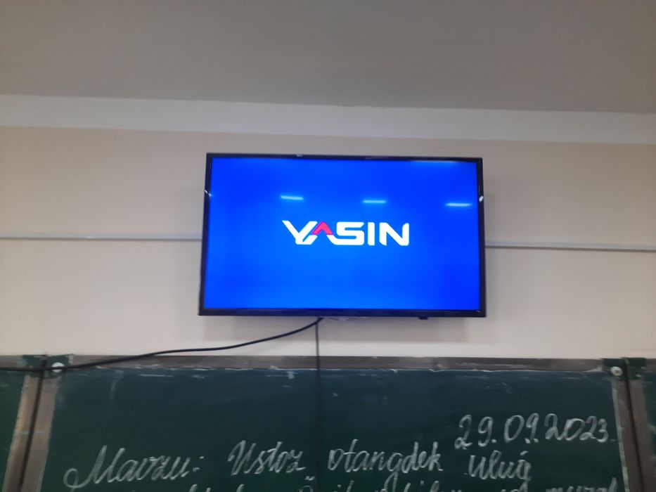 Yasin 32talj. holati qoniqarli