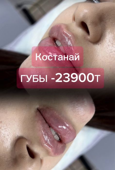 Аугмен губ 23900