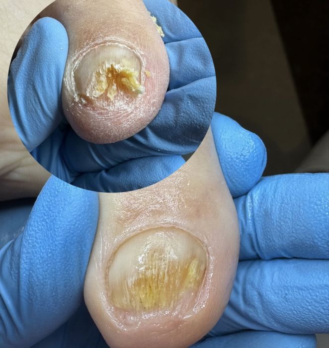 Мужской педикюр от А до Я