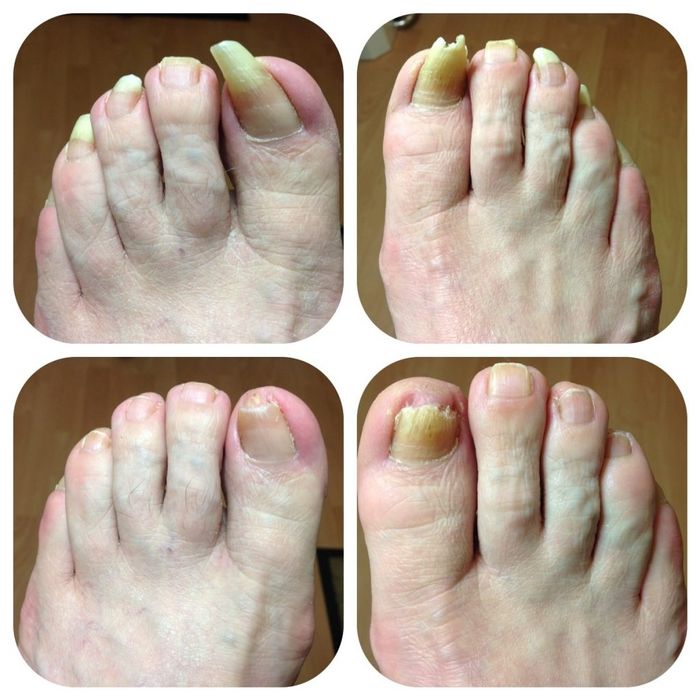 Pedichiura pentru seniori