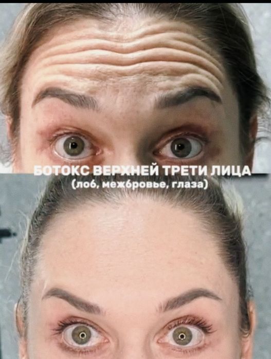 Косметолог с мед. образованием! Доступная косметология