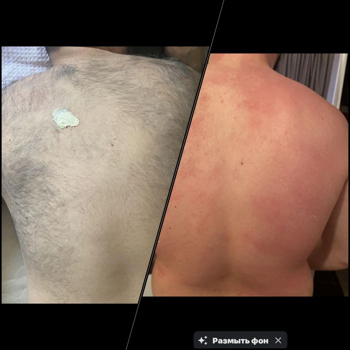 Шугаринг Усть-Каменогорск