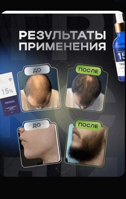 Триоксидил 15% Оригинал Trioxidil Турция