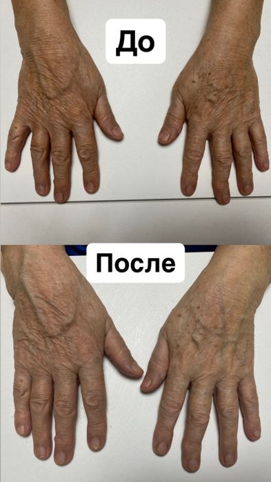 Холодная поазма  в Павлодаре