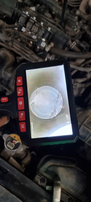 Услуги эндаскоп на выезд