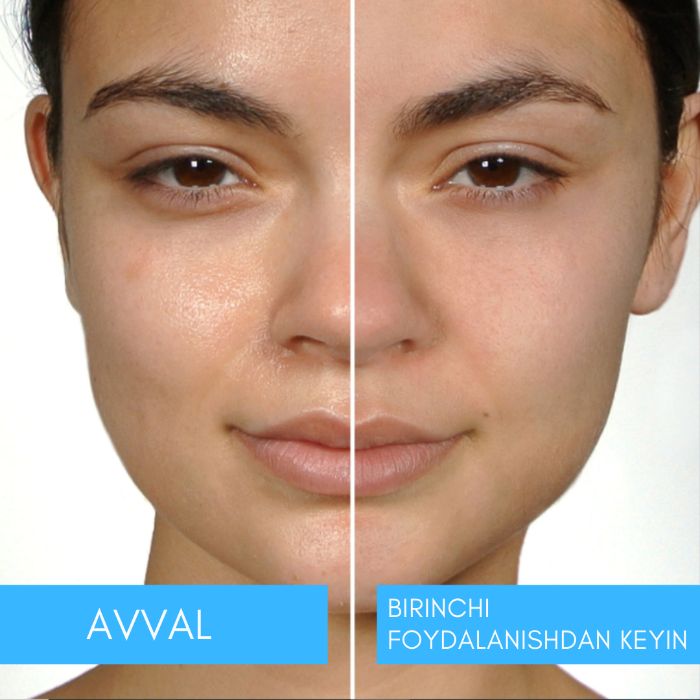 Вакуумный аппарат очиститель для лица