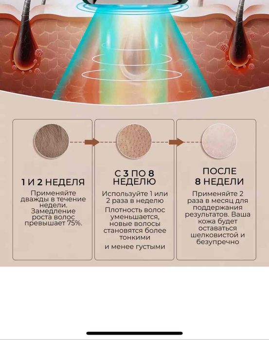 Продам фотоэпилятор.