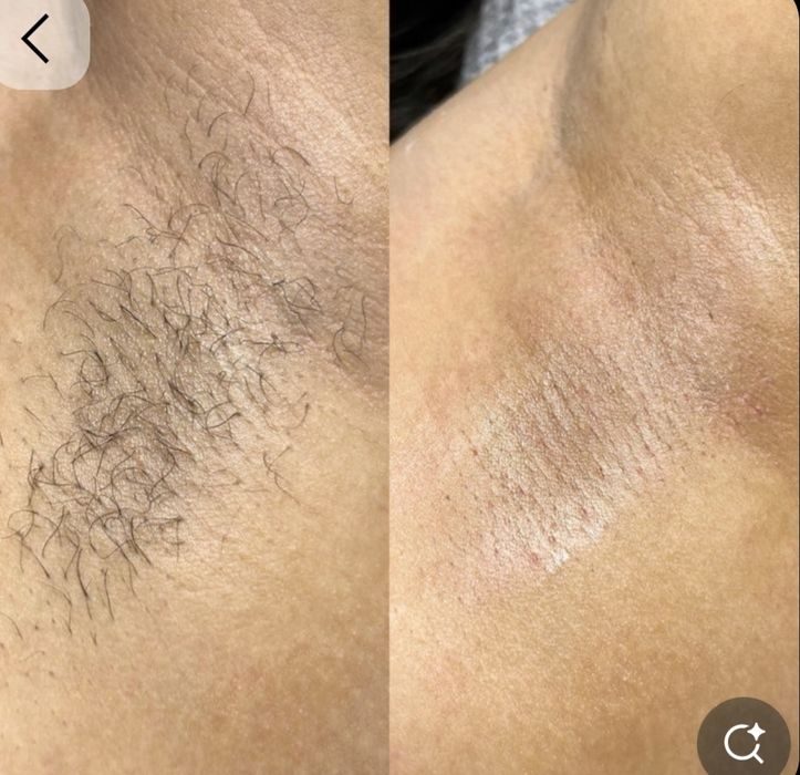 Депиляция хизмати. Кош ламинация .Арзон  ва сифатли. Чакирувга хам чик