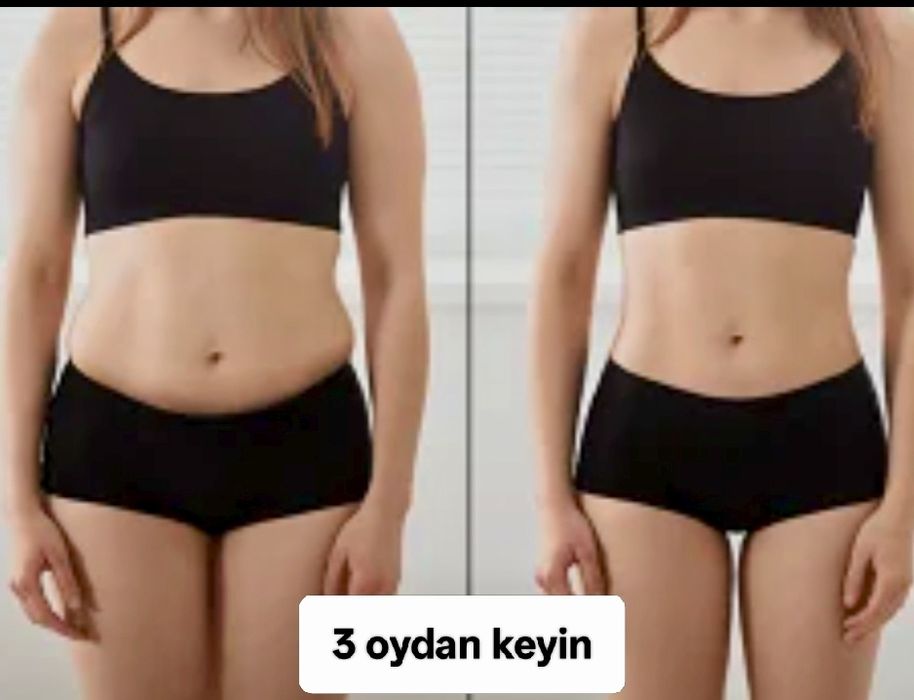 Оземпик, Монархии! Похудения с помощью инъекций. Результат вас удивить