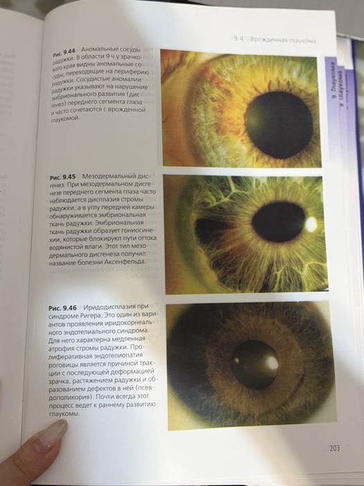 Продам книгу по офтальмологии