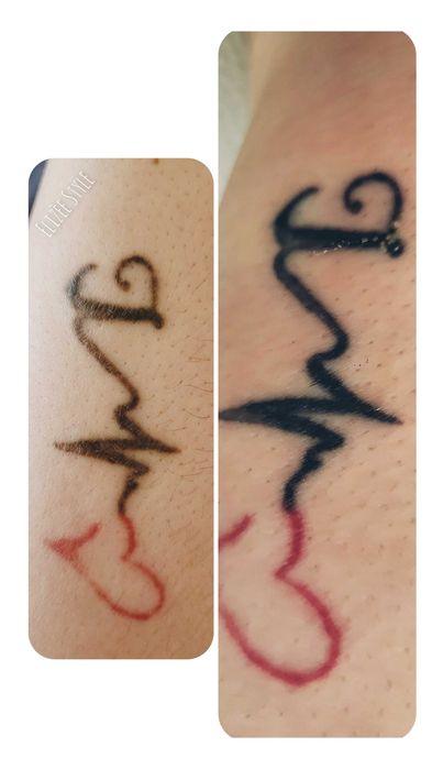 Stergere tatuaje la nivelul sprancenelor si corporale.