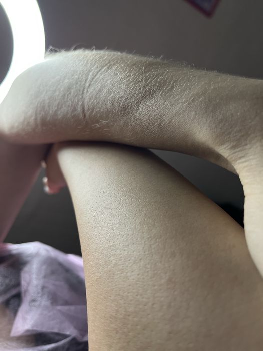 Депиляция: шугаринг, воск, полимер, эластомер