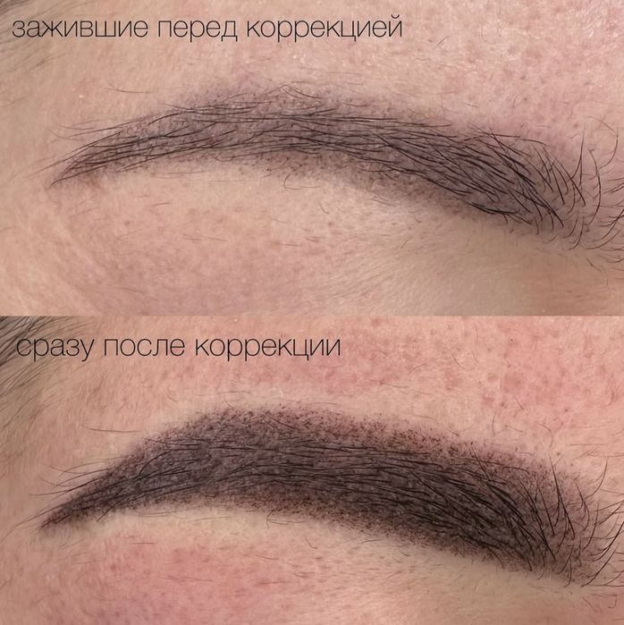 Косметолог лазеролог со стажем 10лет