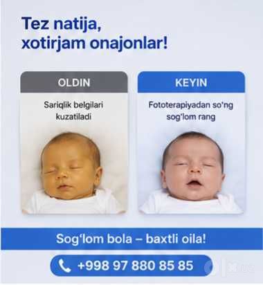 Фотолампа новий оптим