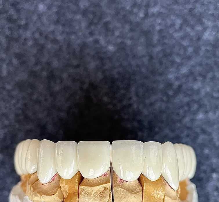 Цифровая стоматология CAD/CAM Зуботехнические услуги