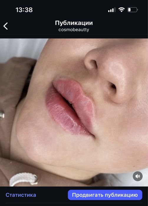 Аугмен губ 23900