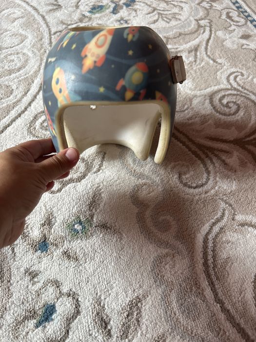 ортапедический шлем для лечения