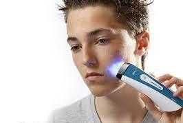 Silk'n Clear - уред за лечение на акне