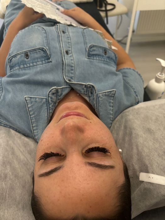 Aplic gene fir cu fir