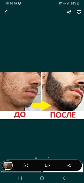 Мезароллер оригинал 2мм