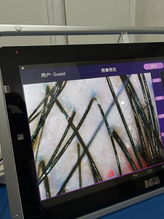 Аппарат для диагностики волос и лица