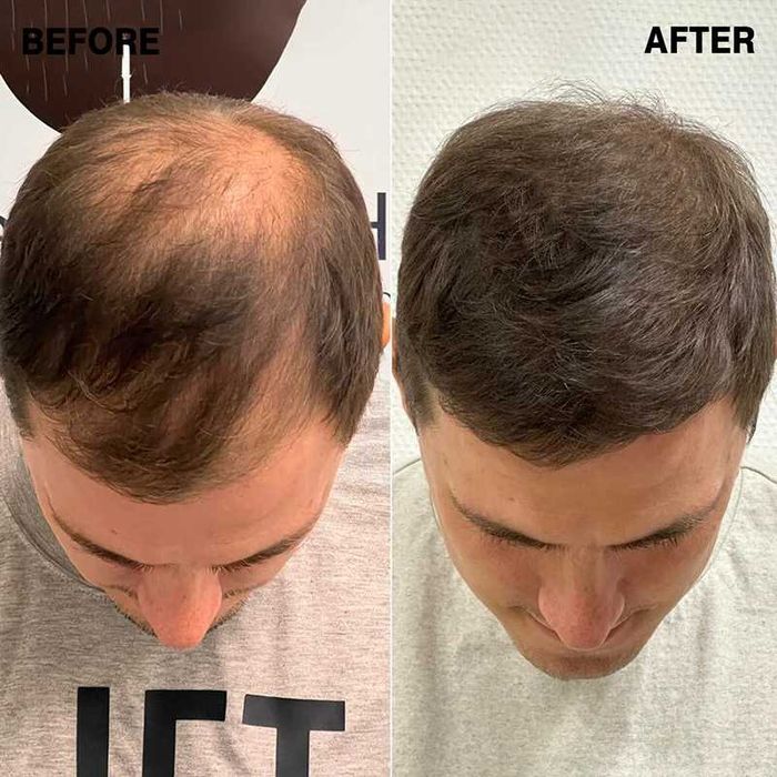 Fibre de par pentru par rar sau chelie - Hairify