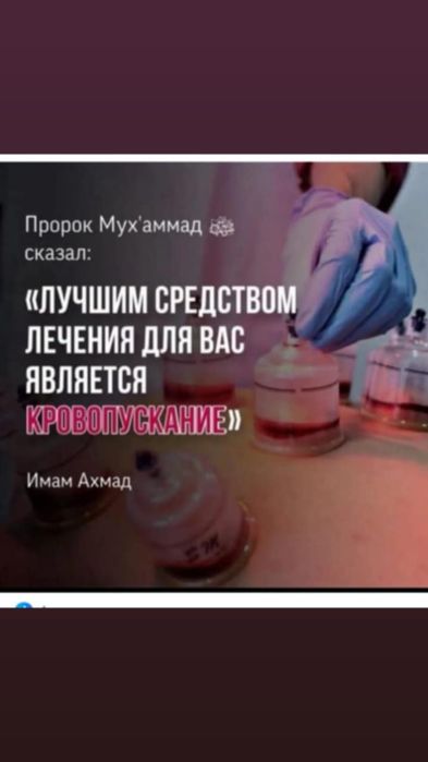 хиджама профессионально.опыт 10 лет