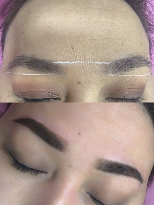 Косметолог лазеролог со стажем 10лет