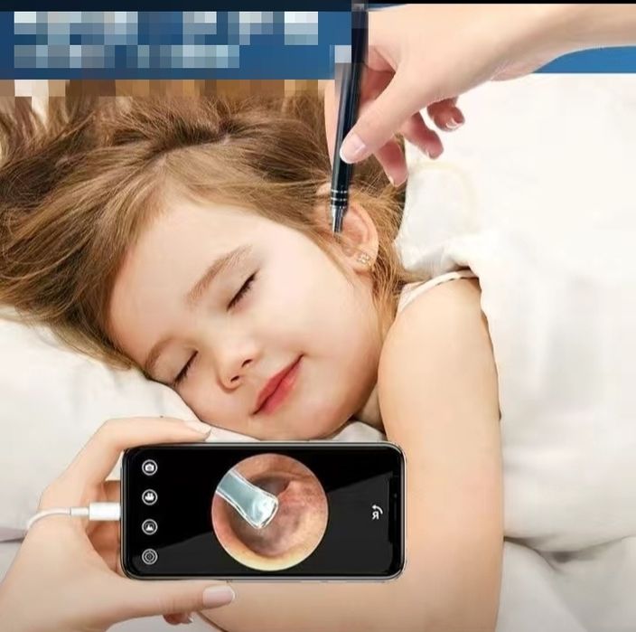 Ухочистка с камерой