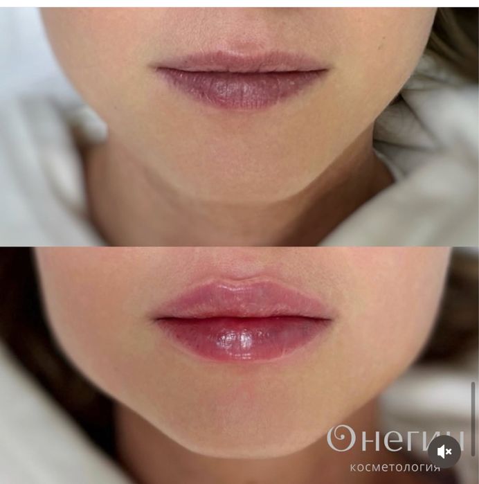 Косметолог на дому