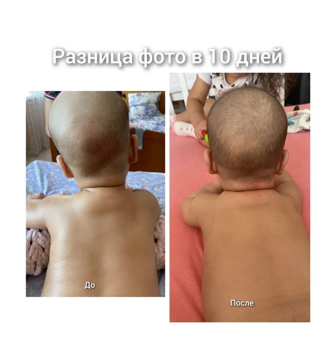 Детский массаж. Электрофорез. Выезд.