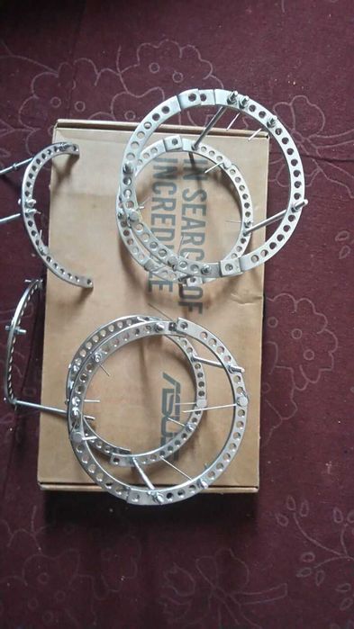 аппарат илизарова