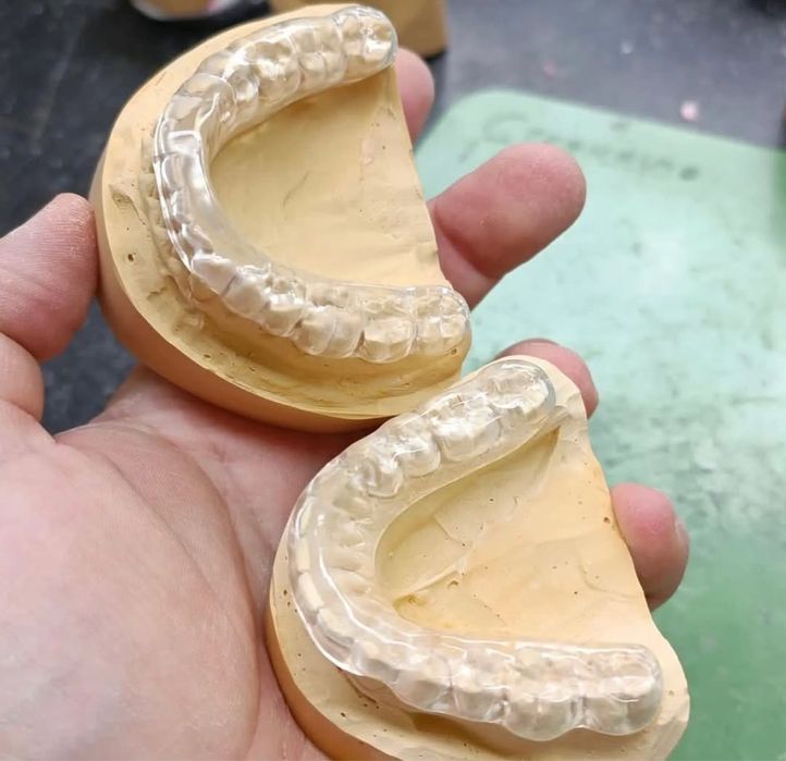 Зубной каппа после брекет