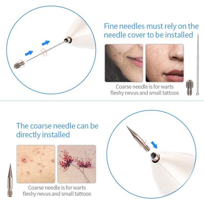 Лазерна плазмена писалка за премахване на лунички, брадавици
