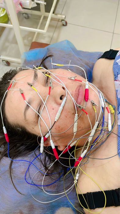 Обучение иглотерапии