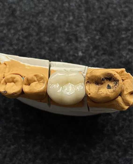 Цифровая стоматология CAD/CAM Зуботехнические услуги