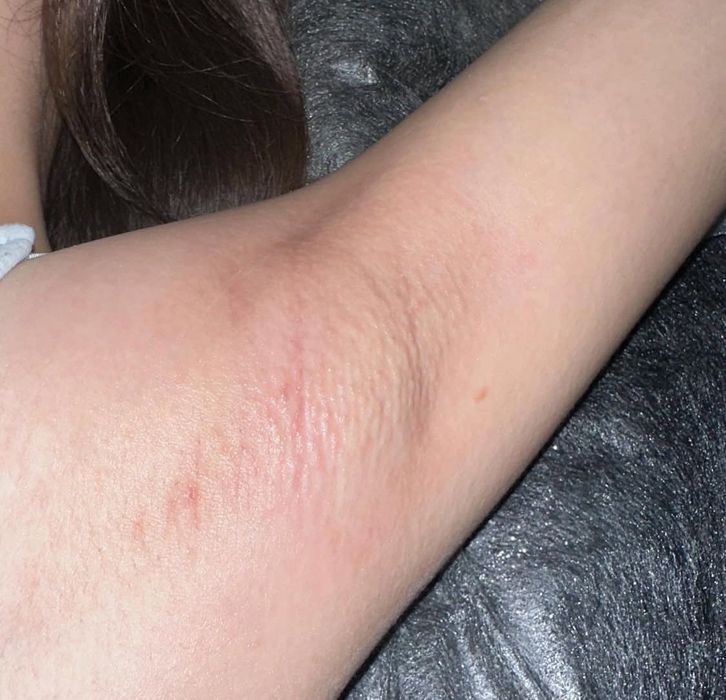 Восковая депиляция