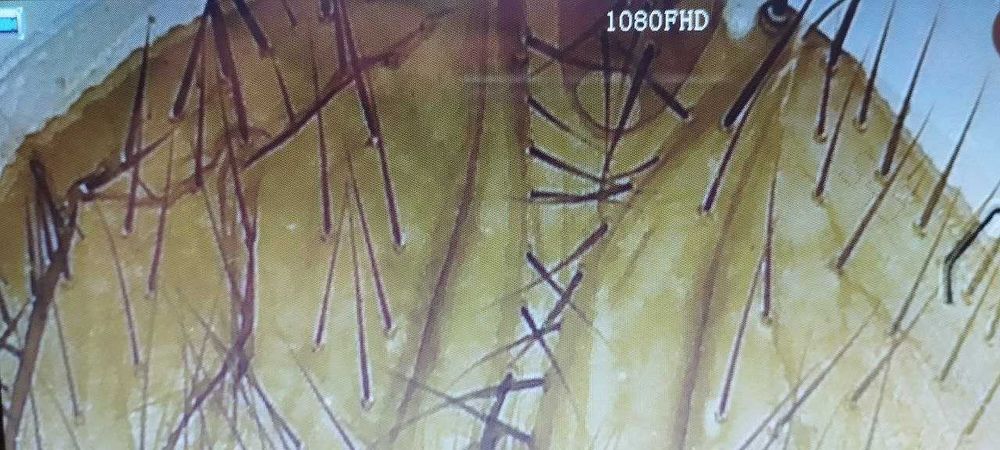 Микроскоп электронный с 7-дюймовым экраном и 12 м камерой.