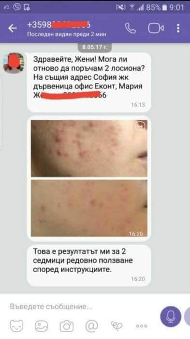 Лосион Против Акне, Мазна Кожа, Разширени Пори и Херпеси - 100мл