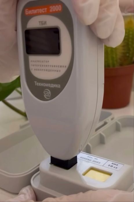 Анализатор Билитест 2000