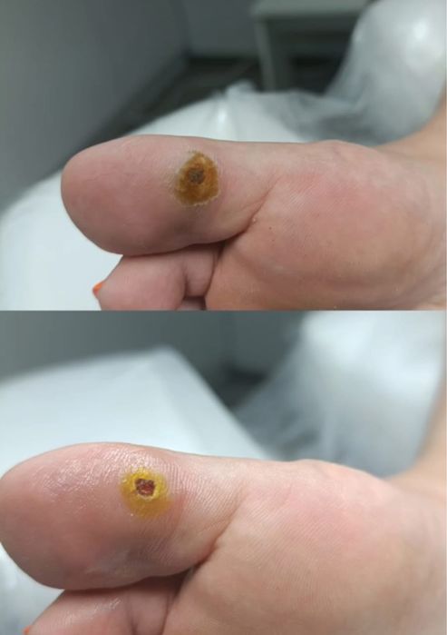 Педикюр на выезд