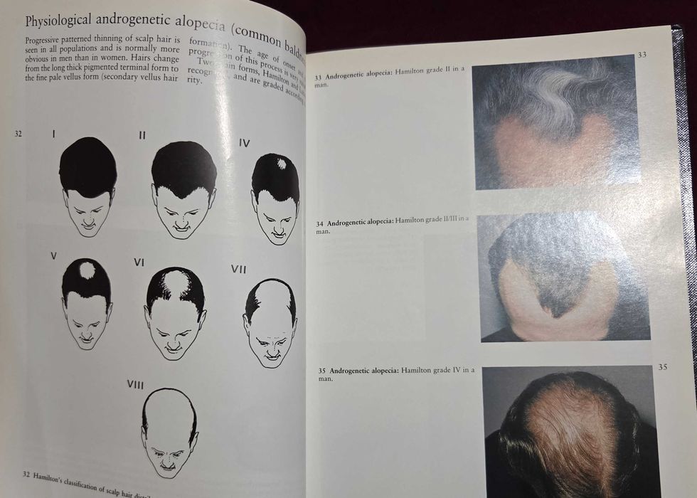 A Colour Atlas of the Hair, Scalp and Nails