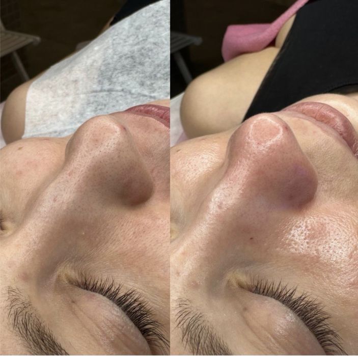 Курсы Косметолога-Эстетиста