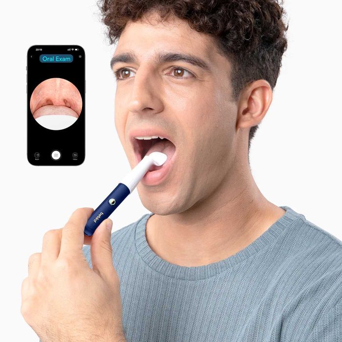 Bebird EarSight Plus – смарт комплект за почистване/преглед на уши,бял