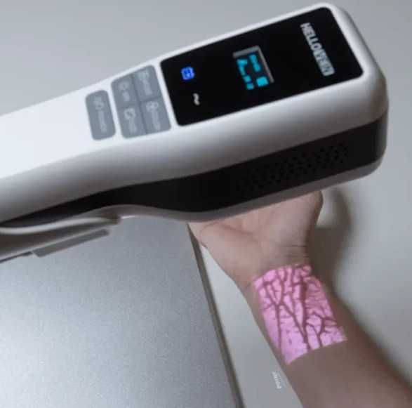 Venovizer – Vena topuvchi tibbiy qurilma | веновизор | Vein Finder