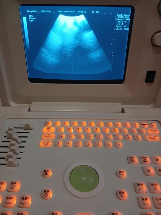 Продаётся Узи аппарат