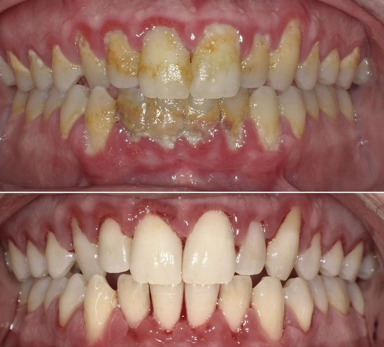 Красивая улыбка уже сегодня | Стоматолог Ташкент