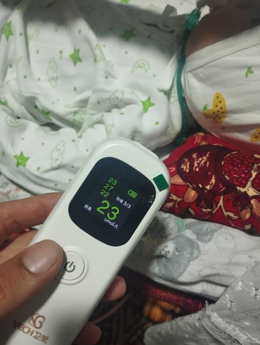 Билрубин олчаб бериш. Служба измерения билирубина